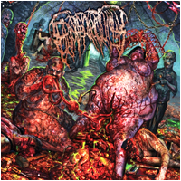 Epicardiectomy - Abhorrent Stench of Posthumous Gastrorectal Desecration