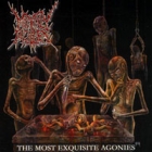 Mindly Rotten - The Most Exquisite Agonies