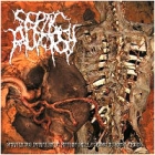Septic Autopsy - Spontaneous Emanation of Rotting Smell Through Necropsy Process